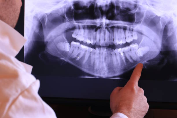 Best Emergency Wisdom Teeth Removal in Reiffton, PA